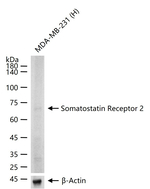 SSTR2 Antibody in Western Blot (WB)