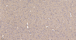 TUBB4B/TUBB2A/TUBB2B Recombinant Rabbit Monoclonal Antibody (10B7)