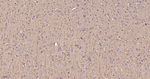 TUBB4B/TUBB2A/TUBB2B Antibody in Immunohistochemistry (Paraffin) (IHC (P))