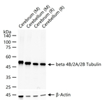 TUBB4B/TUBB2A/TUBB2B Antibody in Western Blot (WB)
