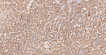 Transferrin Recombinant Rabbit Monoclonal Antibody (2C12)
