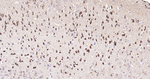 HSP60 Antibody in Immunohistochemistry (Paraffin) (IHC (P))