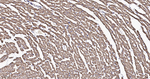 HSP60 Antibody in Immunohistochemistry (Paraffin) (IHC (P))