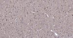 HSP60 Antibody in Immunohistochemistry (Paraffin) (IHC (P))