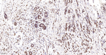 HSP60 Antibody in Immunohistochemistry (Paraffin) (IHC (P))