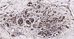 HSP60 Antibody in Immunohistochemistry (Paraffin) (IHC (P))
