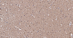 HSP60 Antibody in Immunohistochemistry (Paraffin) (IHC (P))
