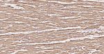 HSP60 Antibody in Immunohistochemistry (Paraffin) (IHC (P))