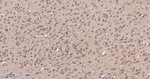 beta Arrestin 1 Antibody in Immunohistochemistry (Paraffin) (IHC (P))