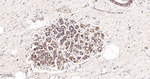 beta Arrestin 1 Antibody in Immunohistochemistry (Paraffin) (IHC (P))