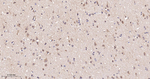 beta Arrestin 1 Antibody in Immunohistochemistry (Paraffin) (IHC (P))