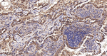 beta Arrestin 1 Recombinant Rabbit Monoclonal Antibody (7B5)