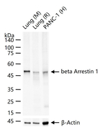 beta Arrestin 1 Antibody in Western Blot (WB)