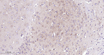 gamma Tubulin Antibody in Immunohistochemistry (Paraffin) (IHC (P))