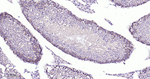 gamma Tubulin Antibody in Immunohistochemistry (Paraffin) (IHC (P))