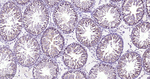 gamma Tubulin Antibody in Immunohistochemistry (Paraffin) (IHC (P))