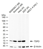 TSPO Antibody in Western Blot (WB)
