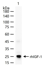 IGF1 Recombinant Rabbit Monoclonal Antibody (11D4)