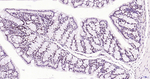 BRD4 Antibody in Immunohistochemistry (Paraffin) (IHC (P))