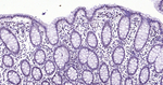 BRD4 Antibody in Immunohistochemistry (Paraffin) (IHC (P))