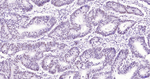 BRD4 Antibody in Immunohistochemistry (Paraffin) (IHC (P))