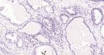 BRD4 Antibody in Immunohistochemistry (Paraffin) (IHC (P))