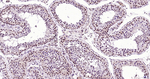 BRD4 Antibody in Immunohistochemistry (Paraffin) (IHC (P))
