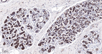 PUMA alpha Antibody in Immunohistochemistry (Paraffin) (IHC (P))