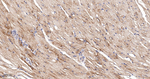 PUMA alpha Antibody in Immunohistochemistry (Paraffin) (IHC (P))