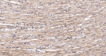 PUMA alpha Antibody in Immunohistochemistry (Paraffin) (IHC (P))