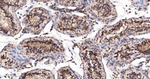 PUMA alpha Antibody in Immunohistochemistry (Paraffin) (IHC (P))
