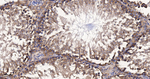 PUMA alpha Antibody in Immunohistochemistry (Paraffin) (IHC (P))