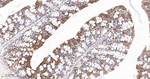 YBX1 Antibody in Immunohistochemistry (Paraffin) (IHC (P))