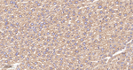 YBX1 Antibody in Immunohistochemistry (Paraffin) (IHC (P))