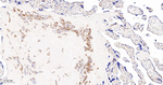 YBX1 Antibody in Immunohistochemistry (Paraffin) (IHC (P))
