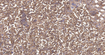 YBX1 Antibody in Immunohistochemistry (Paraffin) (IHC (P))
