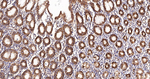 YBX1 Antibody in Immunohistochemistry (Paraffin) (IHC (P))