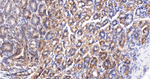 YBX1 Antibody in Immunohistochemistry (Paraffin) (IHC (P))