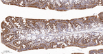 YBX1 Antibody in Immunohistochemistry (Paraffin) (IHC (P))