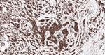 YBX1 Antibody in Immunohistochemistry (Paraffin) (IHC (P))