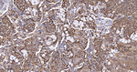 YBX1 Antibody in Immunohistochemistry (Paraffin) (IHC (P))