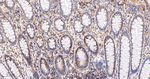 YBX1 Antibody in Immunohistochemistry (Paraffin) (IHC (P))