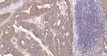 YBX1 Antibody in Immunohistochemistry (Paraffin) (IHC (P))