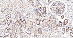 YBX1 Antibody in Immunohistochemistry (Paraffin) (IHC (P))