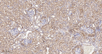 YBX1 Antibody in Immunohistochemistry (Paraffin) (IHC (P))