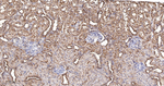 YBX1 Antibody in Immunohistochemistry (Paraffin) (IHC (P))
