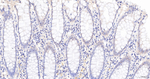 NUP98 Recombinant Rabbit Monoclonal Antibody (12E4)