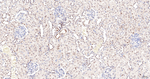 NUP98 Antibody in Immunohistochemistry (Paraffin) (IHC (P))