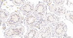 NUP98 Antibody in Immunohistochemistry (Paraffin) (IHC (P))