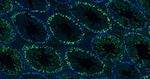 NUP98 Antibody in Immunohistochemistry (Paraffin) (IHC (P))